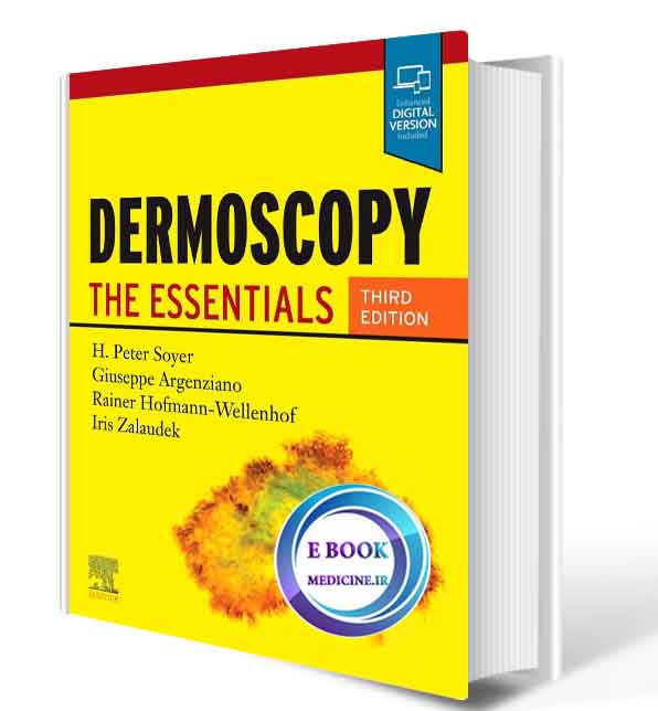 دانلود کتاب Dermoscopy: The Essentials2020( PDF)